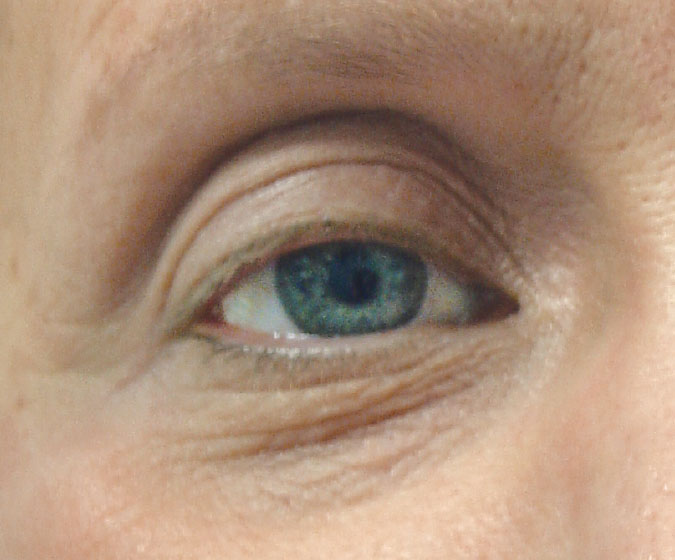 neocutis lumiere riche anti aging intenzív hidratáló)