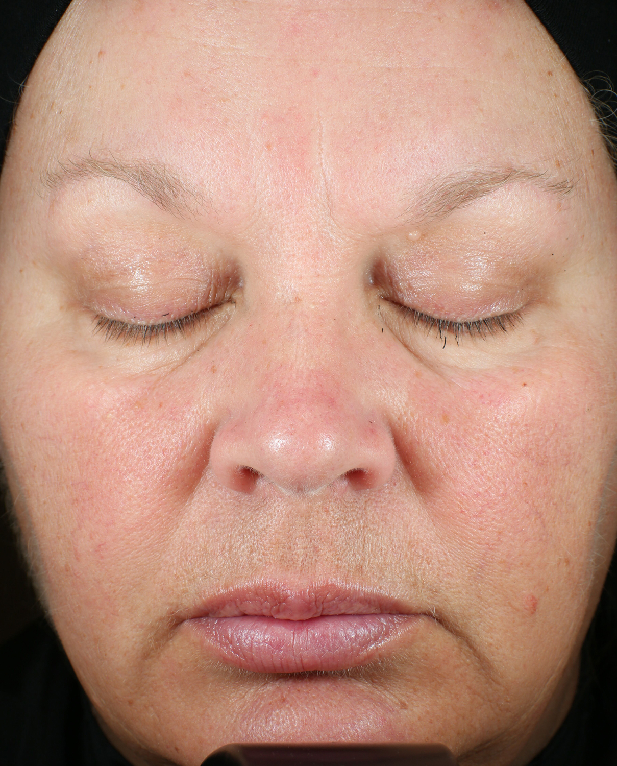 Bio Serum Firm After
