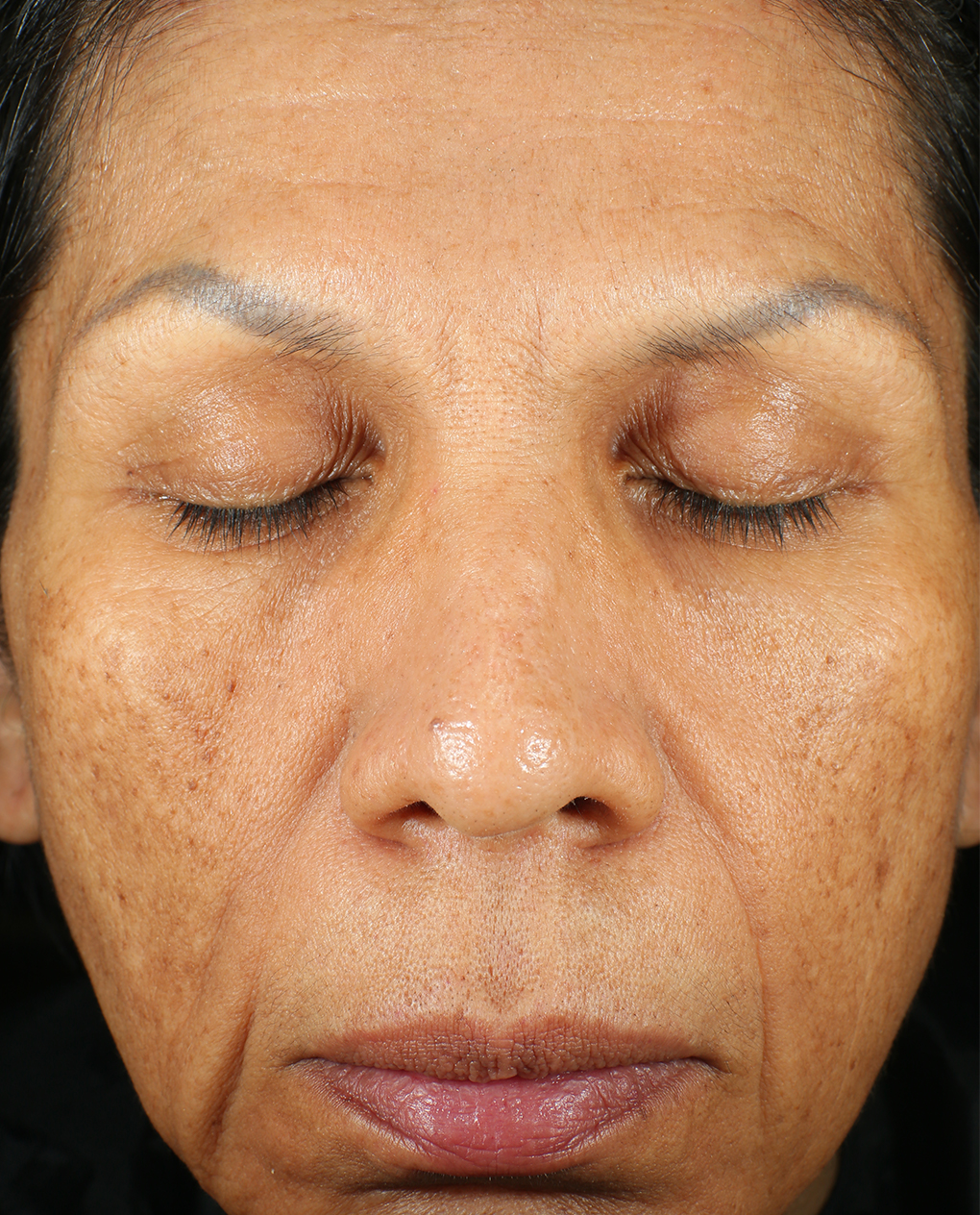 Bio Cream Firm After