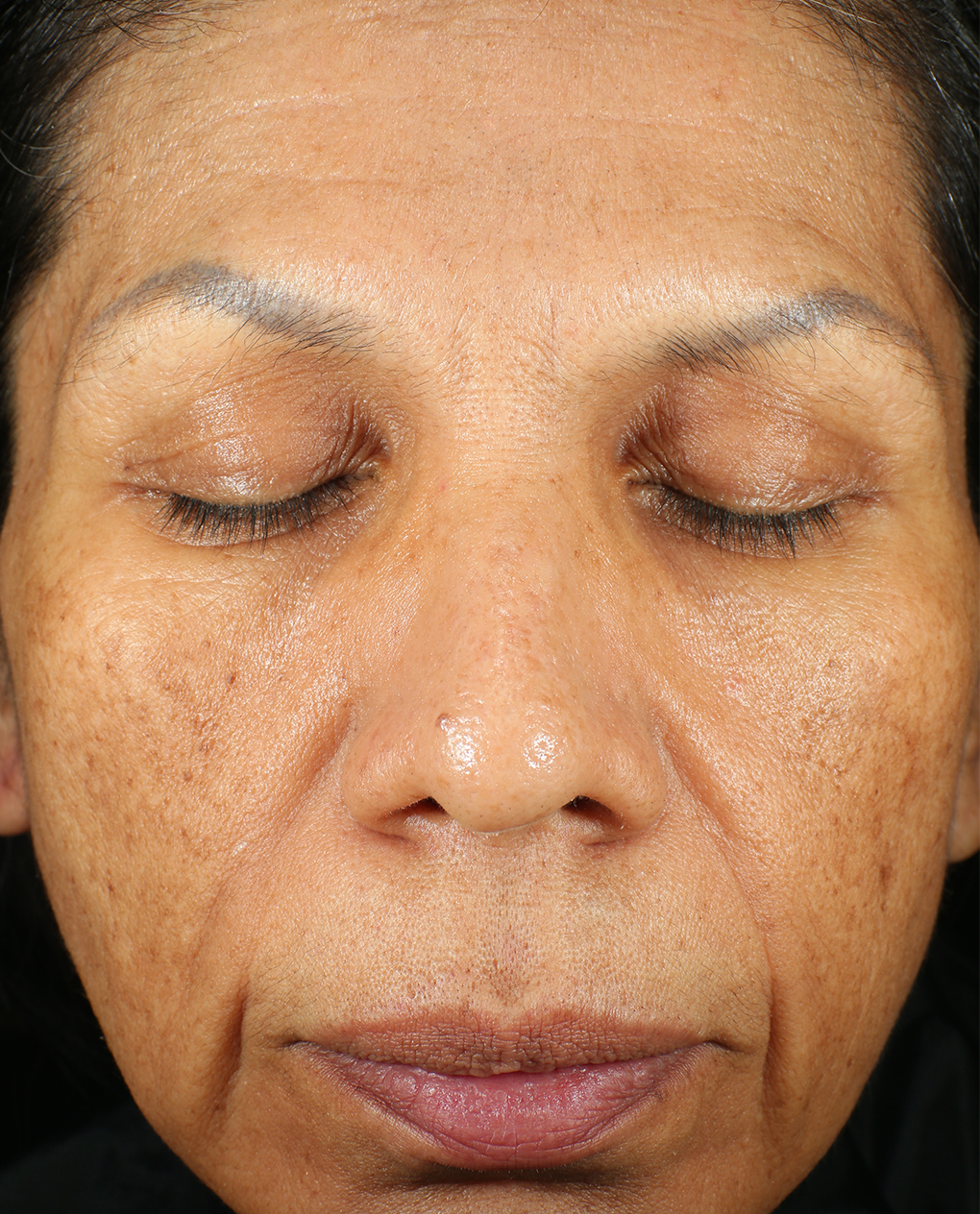 Bio Cream Firm Before