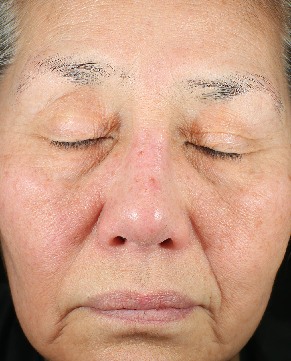 Bio Cream Firm Before